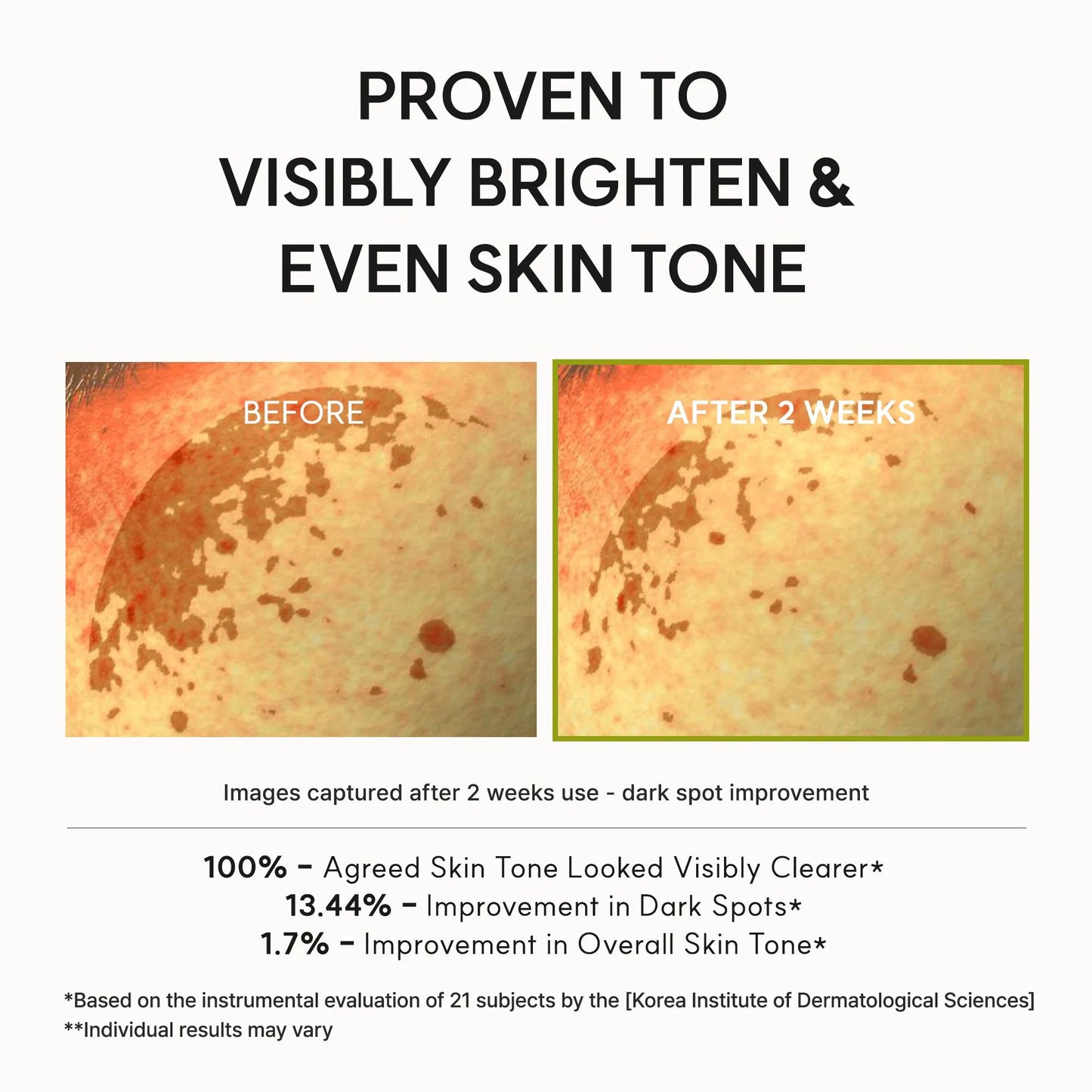 Arencia vitamin c booster shot